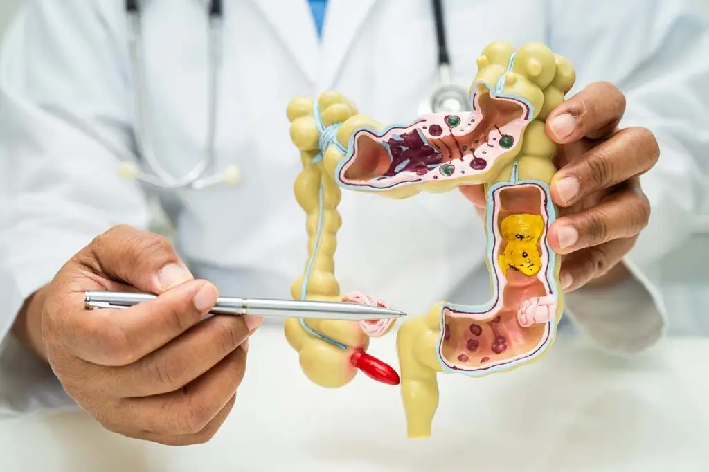 colonoscopy
