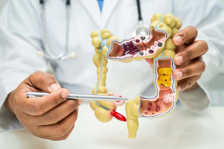 colonoscopy